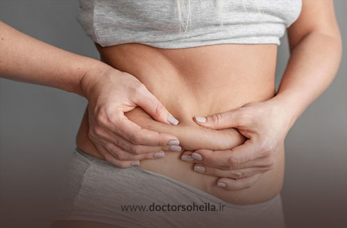 عوارض لیپوساکشن چیست؟ بررسی کامل عوارض شایع و نادر