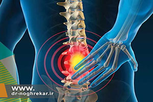 درمان درد دیسک کمر با لیزر پی ال دی دی