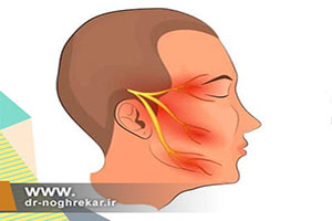 دلایل ایجاد درد عصب سه قلو و صورت چیست؟