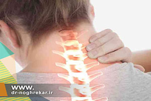 بیماری اسپوندیلوز یا آرتروز گردن یا Cervical Spondylosis چیست؟