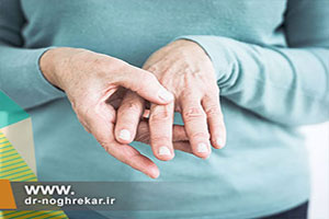 انواع آسیب به مفاصل انگشتان دست
