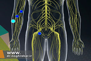 بلوک های عصبی برای مدیریت درد