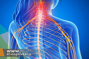 درد گردن و شانه چگونه درمان می شود؟