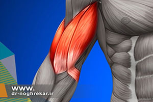 انواع آسیبهای عضله دوسر بازو و درمان آنها