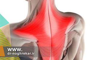 بهترین راه های درمان گردن درد ناشی از آسیب عضله بالا برنده کتف