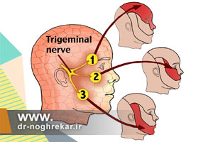 نورالژی تری ژمینال چیست و علت ابتلا به آن؟