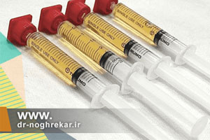 تزریق ارتوکین در تهران | تجربه ای مؤثر در کلینیک دکتر نقره کار