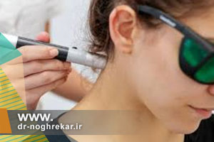 لیزر درمانی دیسک گردن در تهران توسط دکتر نقره کار فوق تخصص درد