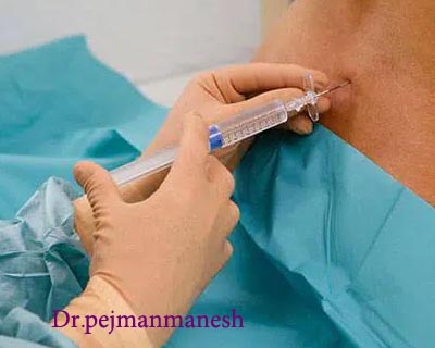 بی حسی اسپاینال