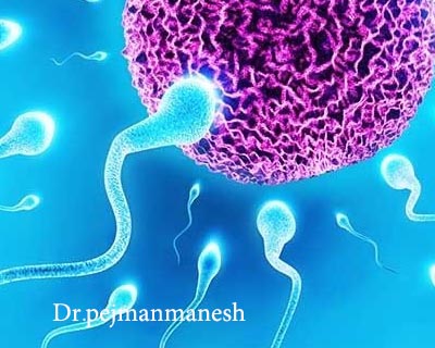 عوامل مؤثر بر کیفیت اسپرم