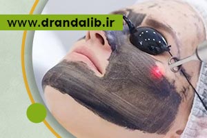 پیلینگ کربن چه روشی است و چه کاربردهایی دارد؟