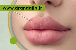 پرطرفدارترین مدل های تزریق ژل لب کدامند؟