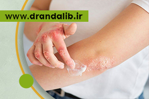بیماری های پوستی؛ علائم، انواع، درمان ها