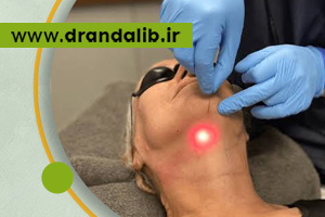 اندولیفت گردن برای لیفت گردن بدون جراحی در مطب دکتر عندلیب