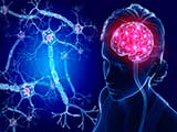 اختلالات و بیماریهای نورولوژیکی مغز شامل چه مواردی می شوند؟