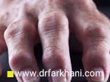 5 علت اصلی کج شدن انگشتان دست