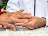 آرتریت انگشتان دست؛ علل، علائم و روشهای درمان