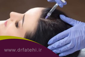 کربوکسی تراپی مو چه تاثیری در جلوگیری از ریزش مو دارد؟