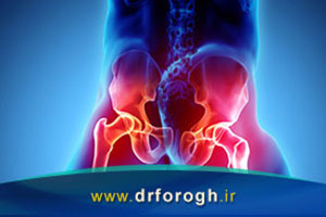 علل درد باسن در پشت لگن