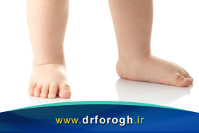 درمان پای صاف کودکان با کفش طبی