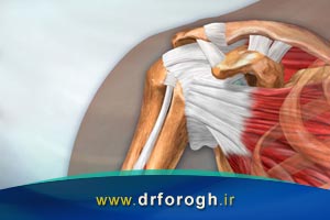 آسیب تاندون شانه شامل کشیدگی، التهاب و پارگی تاندون شانه