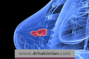 سرطان سينه در زنان و نقش فاکتورهاي محيطي در ايجاد آن