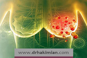 سرطان پستان با چه روشهایی درمان میشود؟