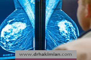 آیا اشعه ماموگرافی زیان آور است؟
