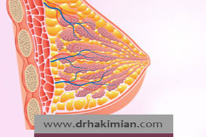 چه کسانی به پستان فیبروکیستیک مبتلا می شوند؟