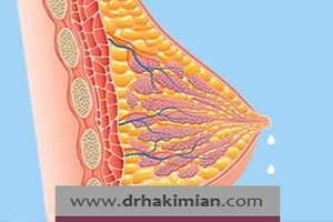 گالاکتوره چیست و به چه علت ایجاد می شود؟