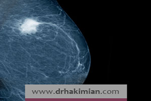 راههای طلایی تشخیص سرطان سینه