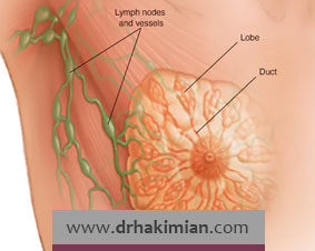 چطور بفهمیم سرطان سینه داریم؟