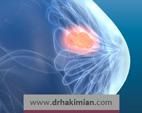سنجش تومور مارکرها برای تشخیص سرطان سینه