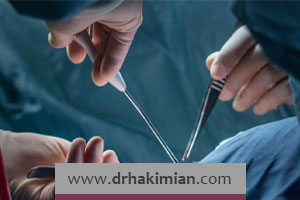 تخلیه سینه در اصفهان توسط دکتر حکیمیان | هزینه عمل ماستکتومی