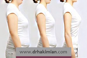 لاغری بعد از ماموپلاستی چه اثری روی جراحی دارد؟