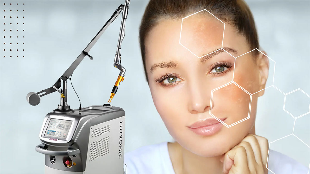 لیزر کیوسوییچ با دستگاه ترای بیم + هزینه لیزر کیوسوئیچ 1404