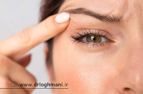 پتوز چیست؟ علل، علائم و روشهای درمان افتادگی پلک