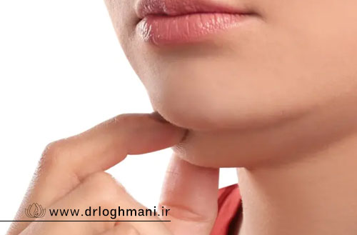 مراقبت های ضروری بعد از لیپوساکشن غبغب
