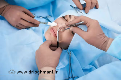 جراحی بینی با لیزر؛ آیا می توان بینی را با لیزر عمل کرد؟