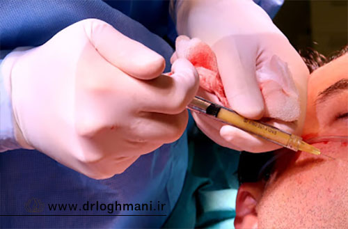 مراقبت های بعد از تزریق چربی صورت؛ راهنمای کامل نقاهت و بهبودی