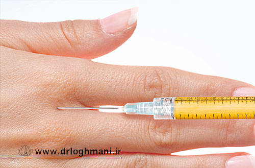 تزریق چربی به دست؛ بهترین روش جوانسازی و رفع لاغری دست ها