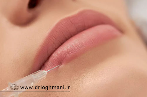 تزریق ژل لب در اصفهان با بهترین دکتر متخصص؛ فرم دهی طبیعی و روسی