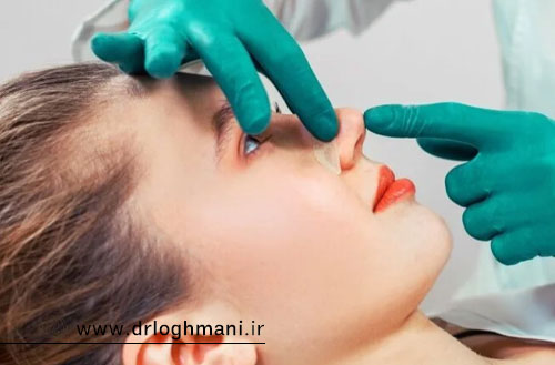 مراقبتهای بعد از عمل بینی؛ راهنمای کامل روند بهبودی