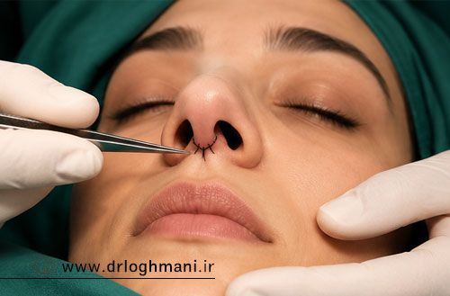 جای بخیه عمل بینی؛ از بخیه تا ترمیم کامل اسکار