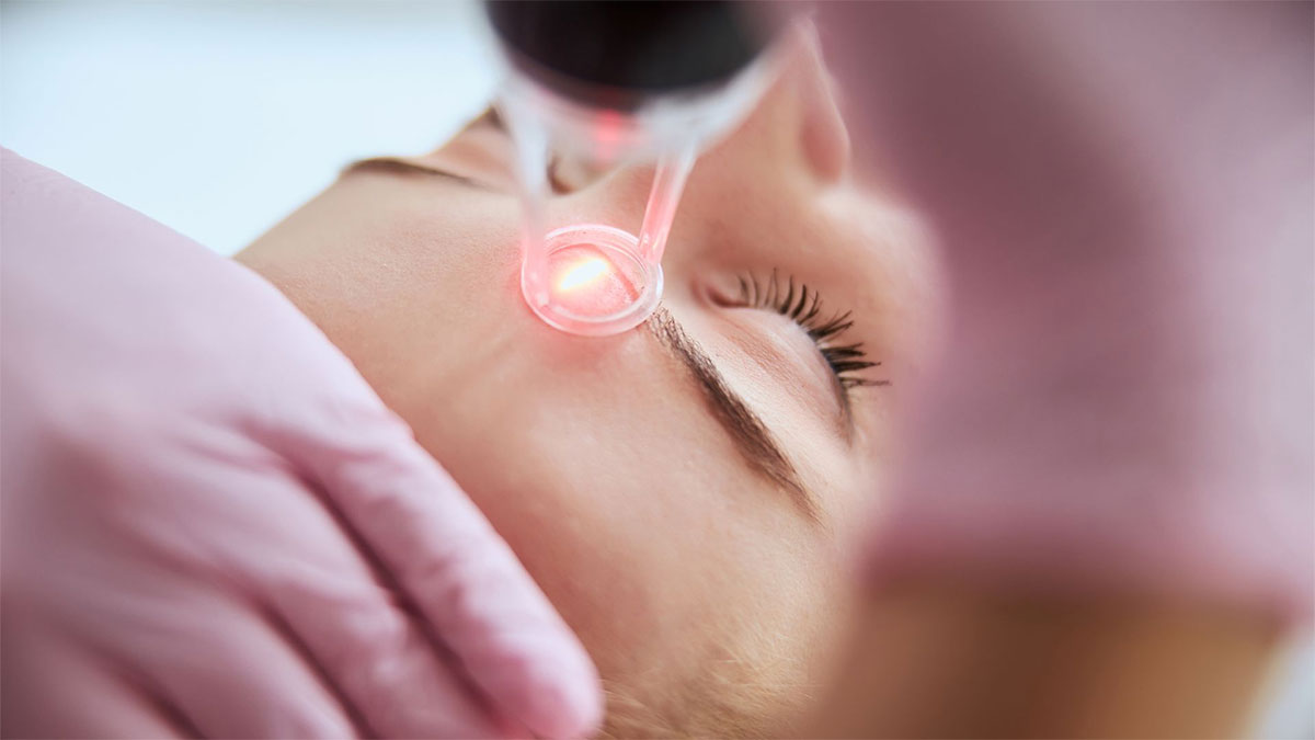 لیزر فرکشنال در اصفهان با بهترین دستگاه؛ کاربرد و هزینه لیزر فرکشنال co2