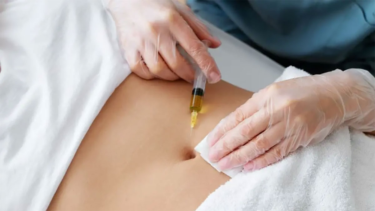 مزوتراپی لاغری| بهترین روش از بین بردن چربی های مقاوم