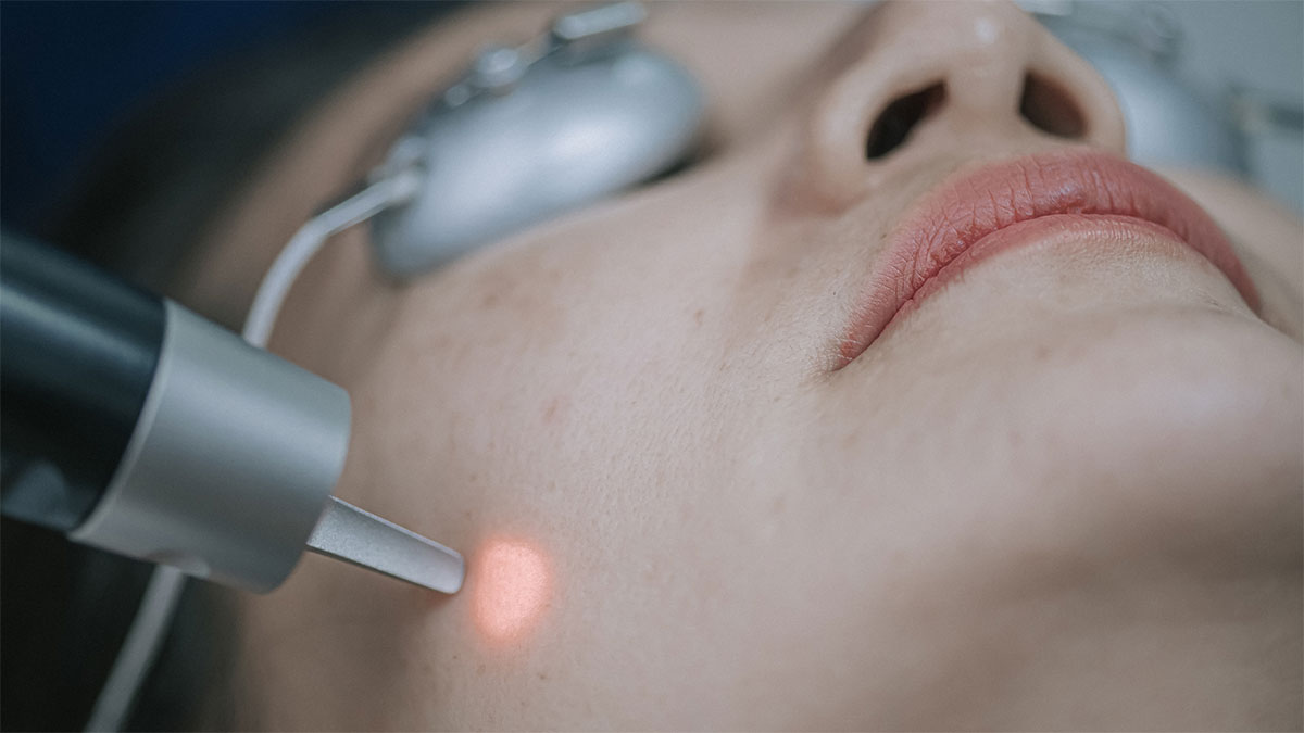 لیزر موهای زائد صورت در اصفهان با روش موثر و پایدار و قیمت مناسب