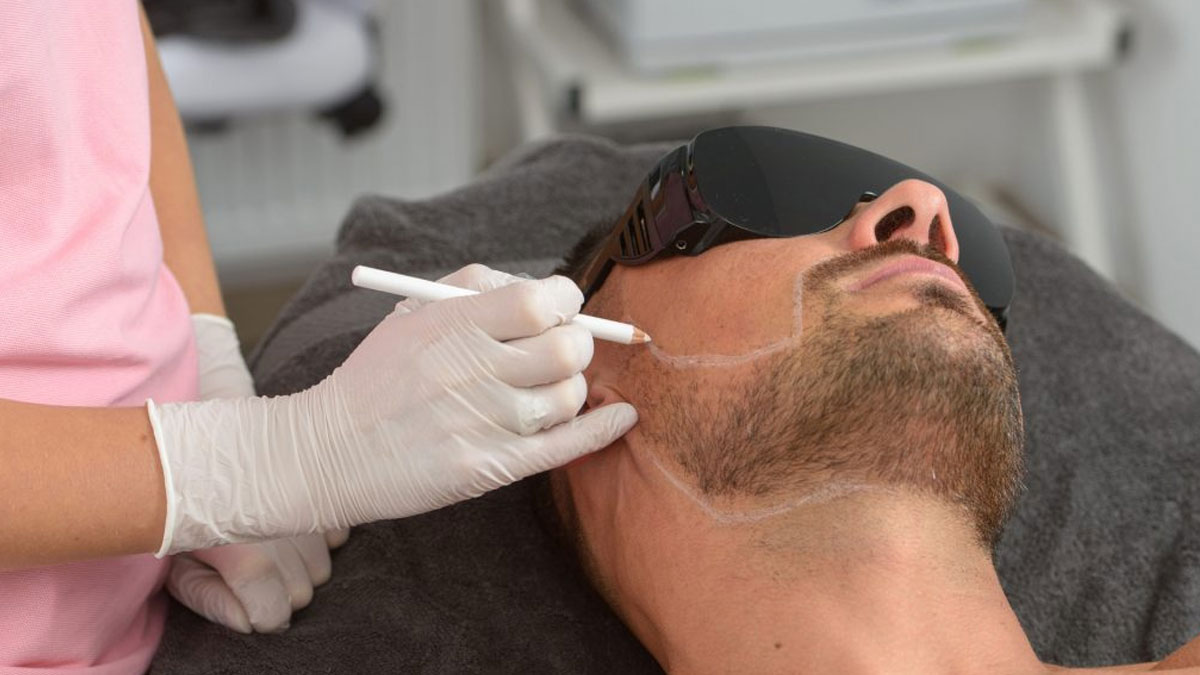 لیزر موهای زائد آقایان| روشی سریع و ایمن برای پوست صاف و بدون مو
