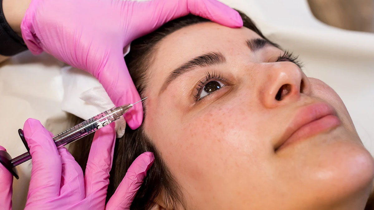 تزریق فیلر شقیقه در اصفهان | هزینه تزریق ژل به شقیقه
