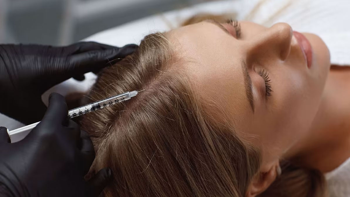 مزوتراپی مو در کلینیک تخصصی دکتر حداد در اصفهان